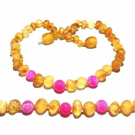 Adult Nurture Raw Honey Pink Dragon Agate Baltic Amber Anklet Love Amber X