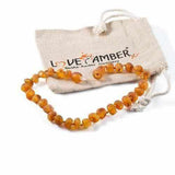 Adult Bees Knees Raw Honey Baltic Amber Anklet Love Amber X