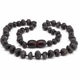 Adult Cherryaid Black Raw Dark Cherry Baltic Amber Anklet Love Amber X