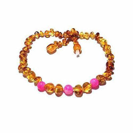 Adult Honeysuckle Polished Honey Baltic Amber Pink Agate Anklet Love Amber X