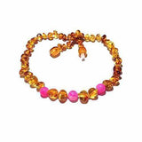 Adult Honeysuckle Polished Honey Baltic Amber Pink Agate Anklet Love Amber X