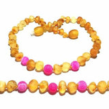 Adult Nurture Raw Honey Pink Dragon Agate Baltic Amber Anklet Love Amber X