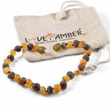 Adult Pippin Raw Green and Honey Baltic Amber Anklet Love Amber X
