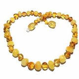 Adult Popcorn Butterscotch Honey Baltic Amber Anklet Love Amber X