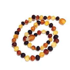 Adult Shingle Raw Mixed Baltic Amber Anklet Love Amber X