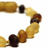 Adult Shingle Raw Mixed Baltic Amber Bracelet Love Amber X