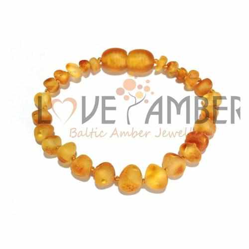 Child Bees Knees REAL Raw Honey Baltic Amber Anklet Bracelet