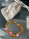 Child Honeysuckle Pink Agate Polished Honey Baltic Amber Anklet Bracelet Love Amber X