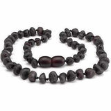 Childs Cherryaid Raw Unpolished Cherry Baltic Amber Bead Necklace Love Amber X